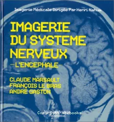 Imagerie du système nerveux : l'encéphale