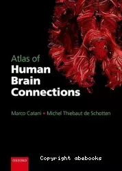 Atlas of human brain connections
