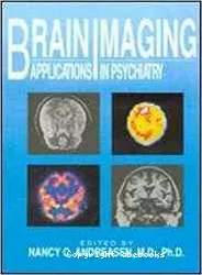 Brain imaging : applications in psychiatry