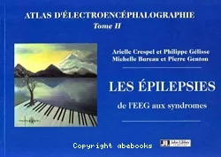 Atlas d'électroencéphalographie, 2 : les épilepsies, de l'EEG aux syndromes